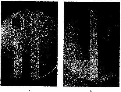 Full size image: 118 kB, FIGURE 8 Chromatography illustrating the inhibitory effect upon the growth of the staphylococcus around the antibiotically active zone; undimensional ascending paper chromatography