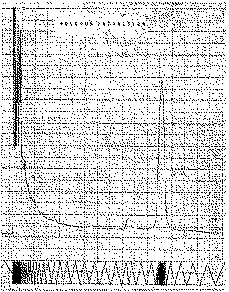 Full size image: 116 kB, 7. Gas chromatogram of trimethylsilyl derivative of LSD after aqueous extraction with chloroform from sodium bicarbonate solution
